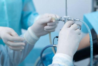 The surgeon's hands hold the gyroscope medical instrument during the hysteroscopy operation.